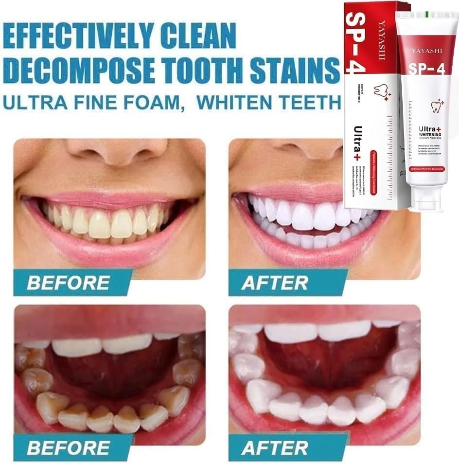 YAYASHI SP-4 Ultra Whitening Probiotic Toothpaste | Advanced Stain Removal & Fresh Breath Oral Care | Red Tube Formula
